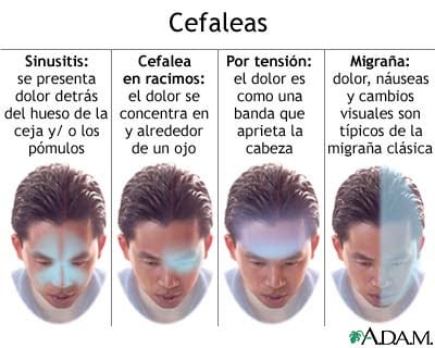 tipos de cefaleas